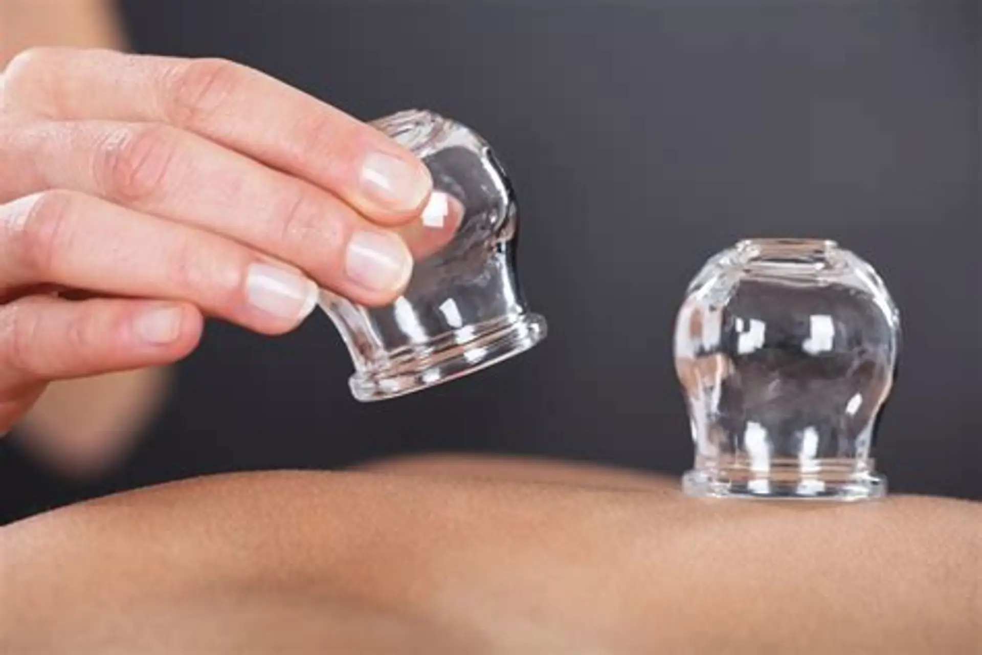 Cupping Therapy in Thane Maharashtra